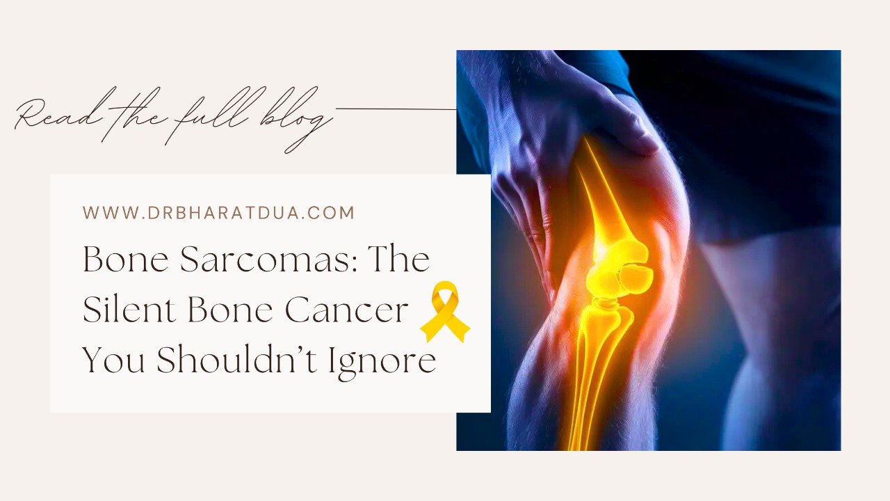 Bone Sarcomas: The Silent Bone Cancer You Shouldn’t Ignore